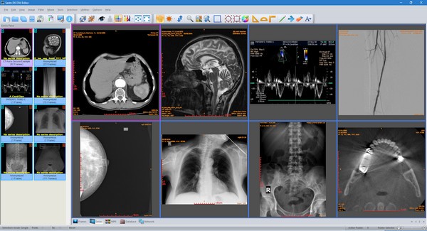 Sante DICOM Editor(DICOM编辑器) v7.8.9-Sante DICOM Editor(DICOM编辑器) v7.8.9免费下载